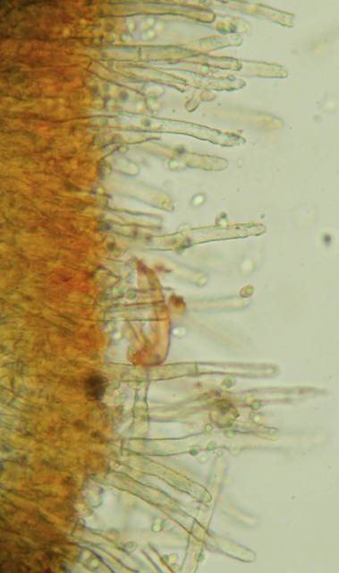 Amphinema byssoides? (Amphinema byssoides)